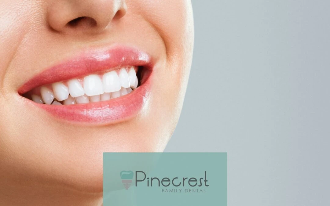 teeth whitening